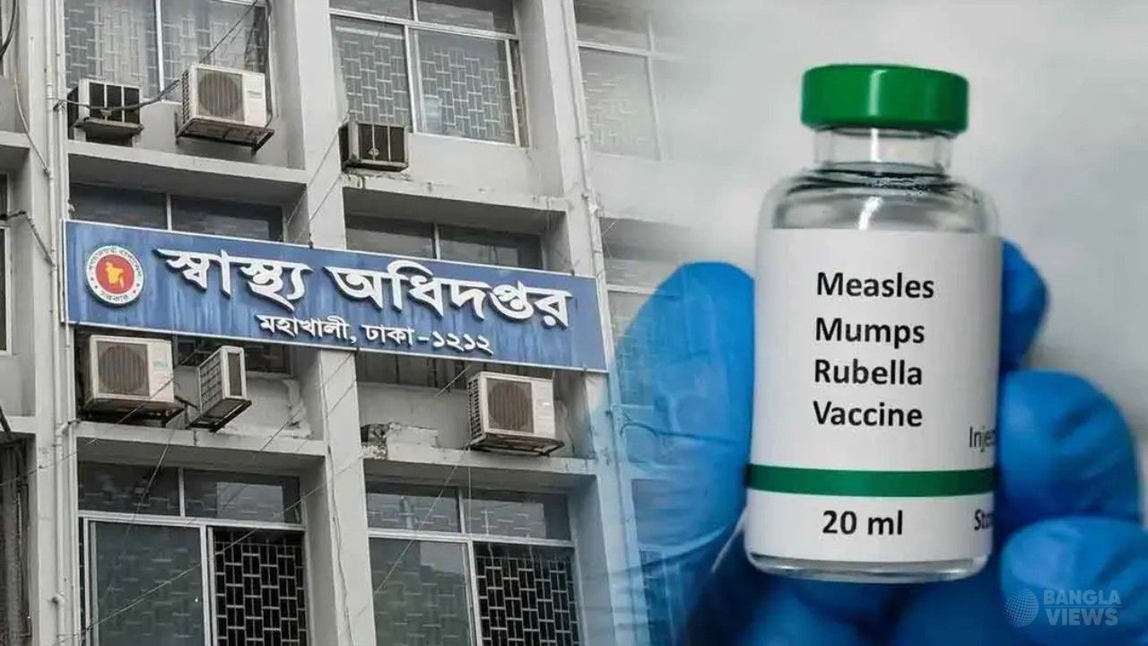 দেশে হাম ও উপসর্গে মৃত্যু ১,০৫৭, সন্দেহভাজন আক্রান্ত প্রায় ১ লাখ ৮০ হাজার
