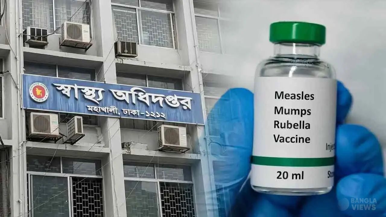 হামের উপসর্গে আরও ৫ মৃত্যু, মোট প্রাণহানি ১১০৪