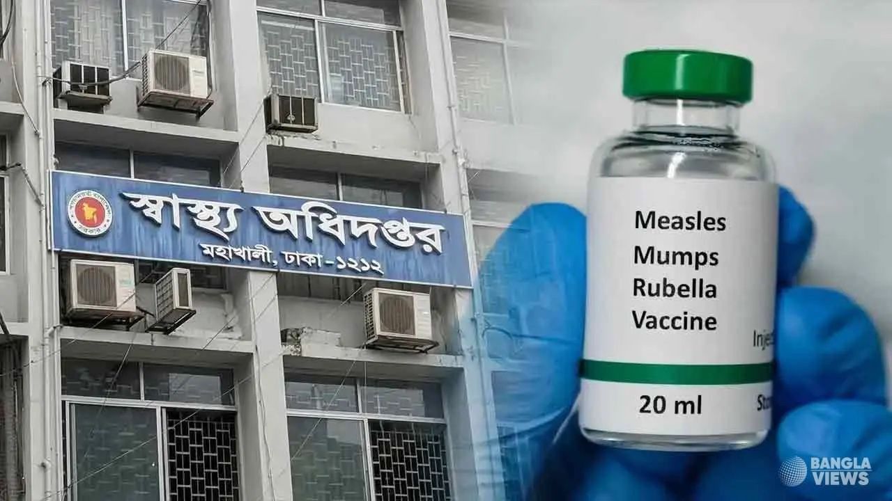 হামের উপসর্গে আরও দুই মৃত্যু, হাসপাতালে ১৪২১ রোগী